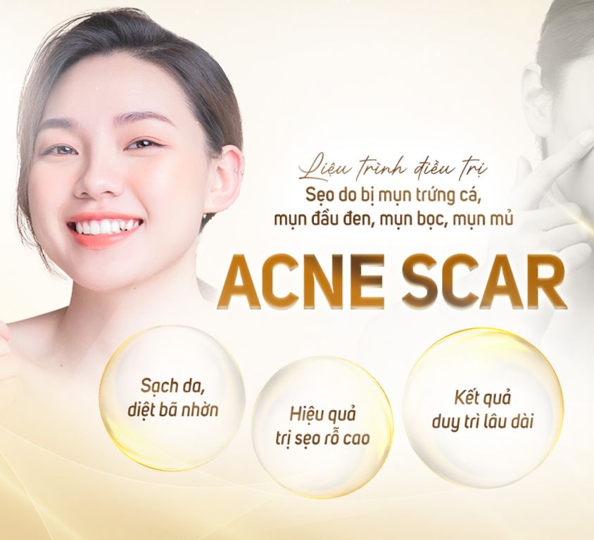Acne Scar 1