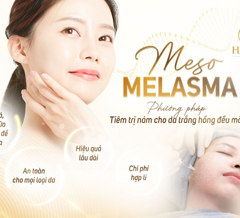 Melasma 1