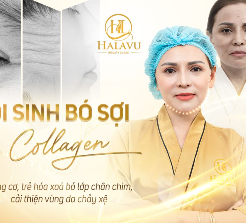 NỘI SINH BÓ SỢI COLLAGEN 1-2