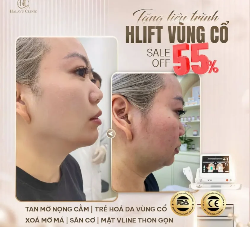 nâng cơ trẻ hoá da 3