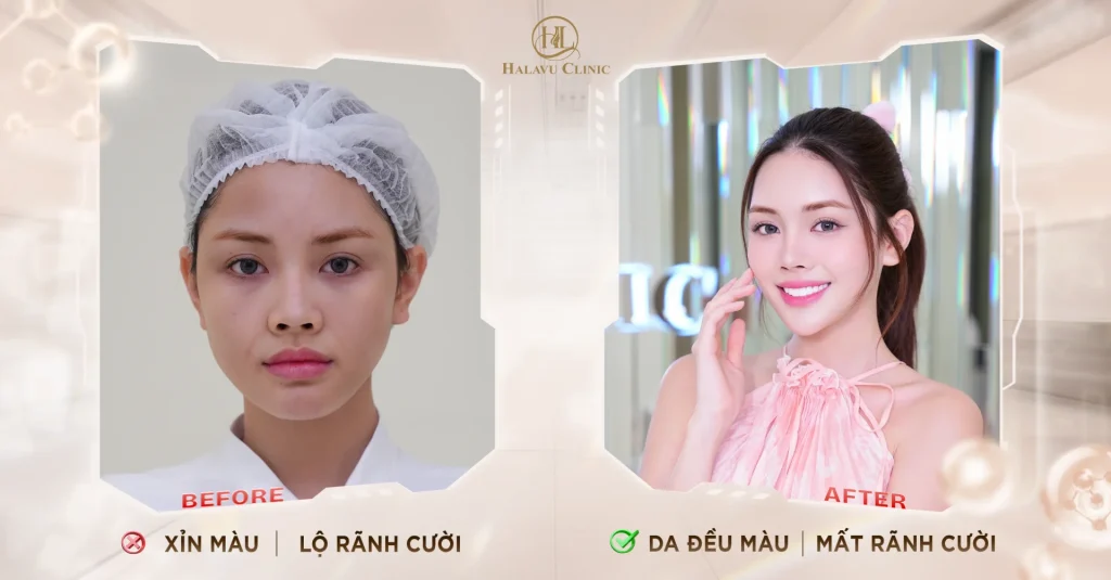 Đan Tiên - Tìm lại nét rạng rỡ vốn có